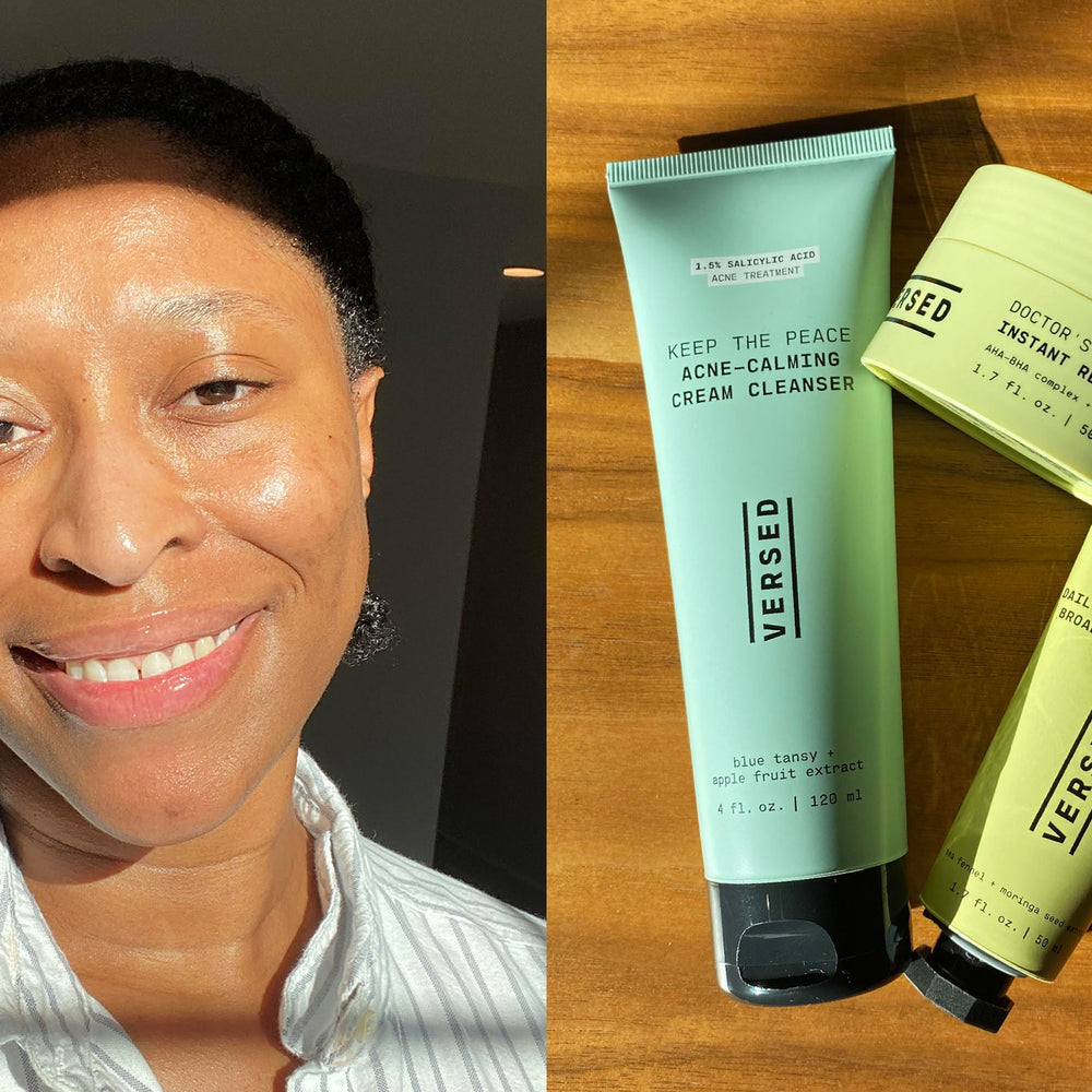 As a Black Woman, I’m Prone to Dark Spots. Here’s What Helped Heal Them
