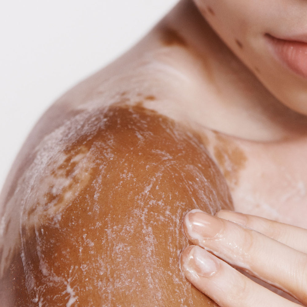 How to Treat Keratosis Pilaris, Eczema, and Other Common Skin Conditions