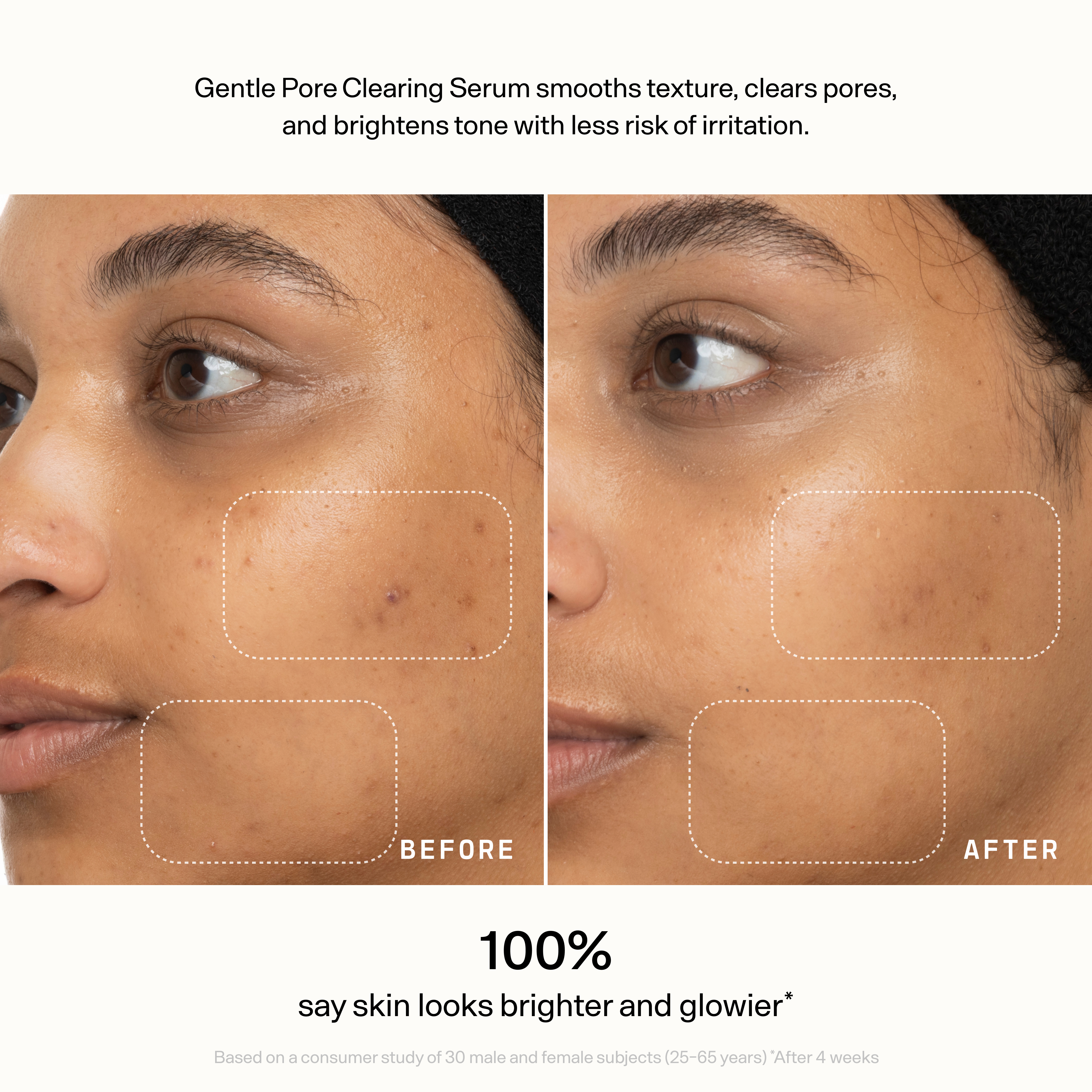 Skin Refine